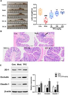 Study on mechanism of action of total flavonoids from Cortex Juglandis Mandshuricae against alcoholic liver disease based on “gut-liver axis”